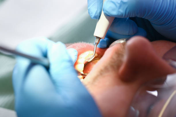 Best Emergency Gum Treatment in Cave City, KY
