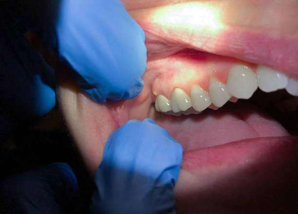 Best Pediatric Emergency Dentist in Cave City, KY